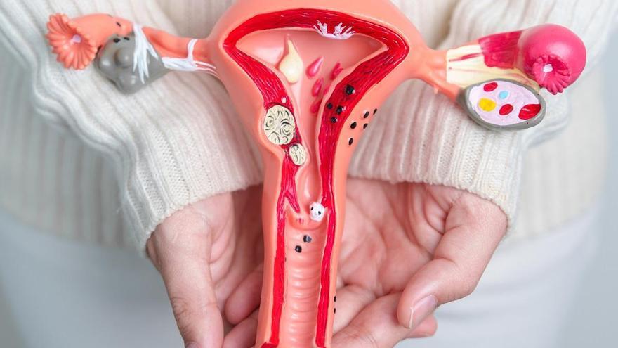 Cáncer de ovarios: ¿A partir de qué edad hay que realizar una revisión ginecológica específica?