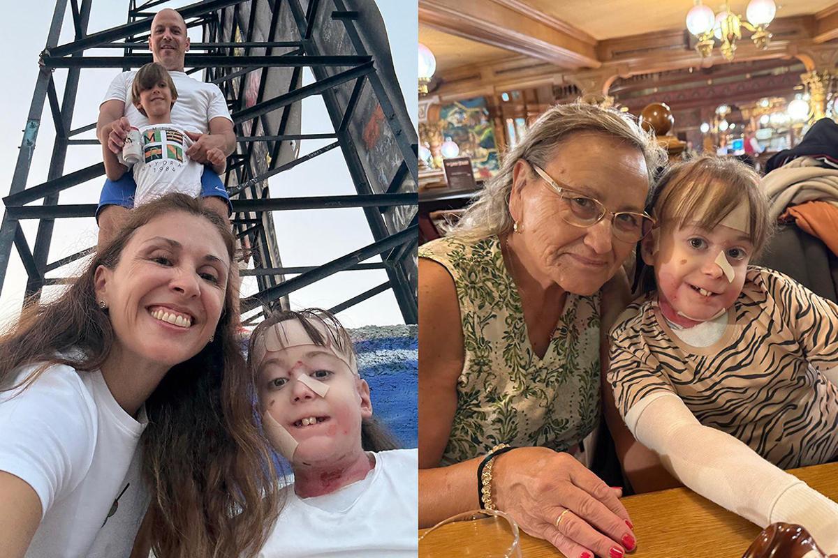 María Victoria Berral, madre de una niña con piel de mariposa