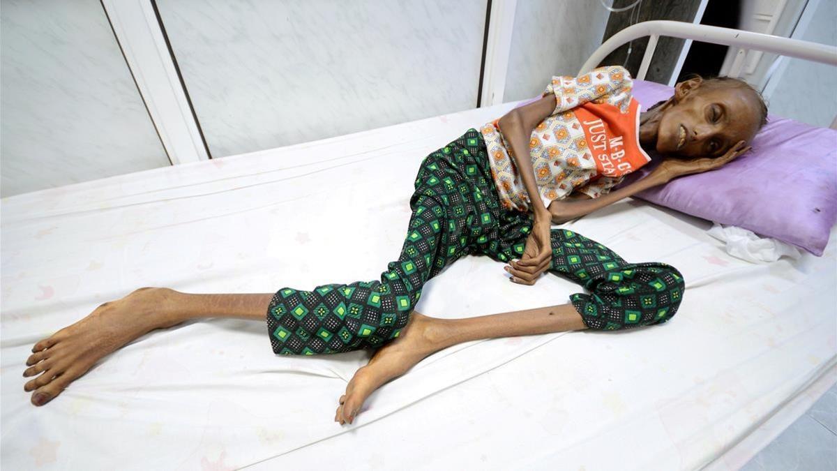 crisis humanitaria en el yemen