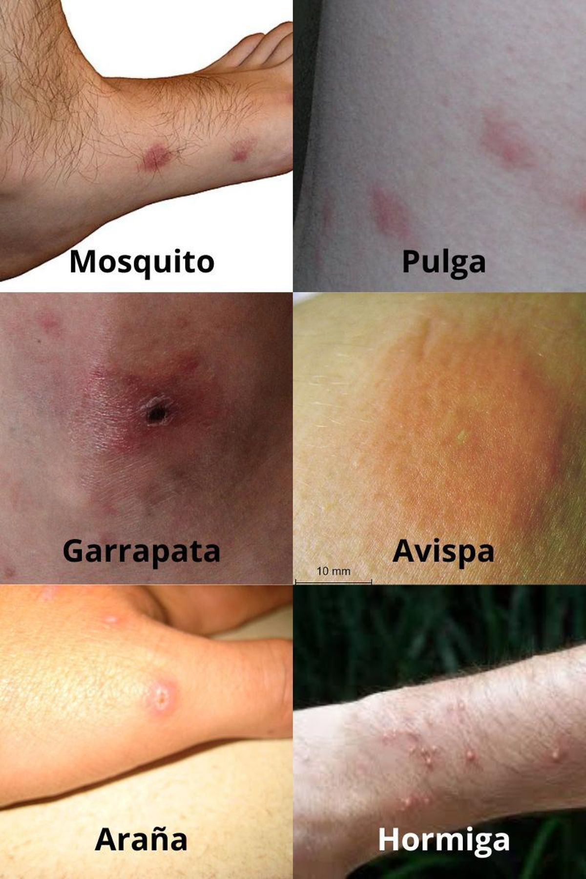 Tipos de picaduras de insectos en verano