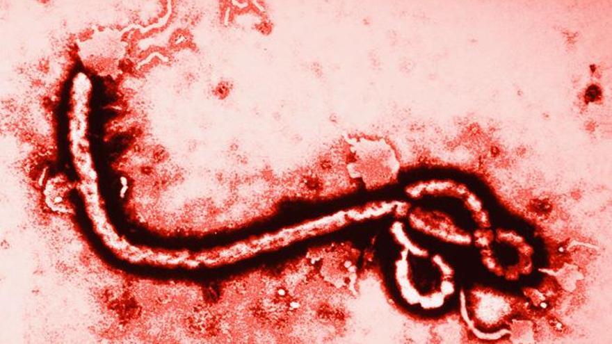 El ébola no tiene un tratamiento específico de eficacia probada.