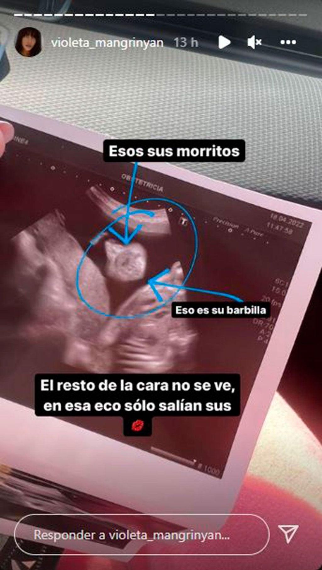 La bebé de Violeta Mangriñán pone morritos en la eco
