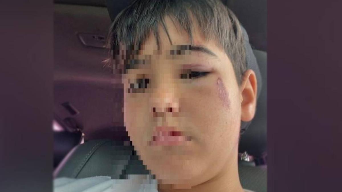 El menor, con las heridas que le causó el agresor, en una imagen cedida por la familia