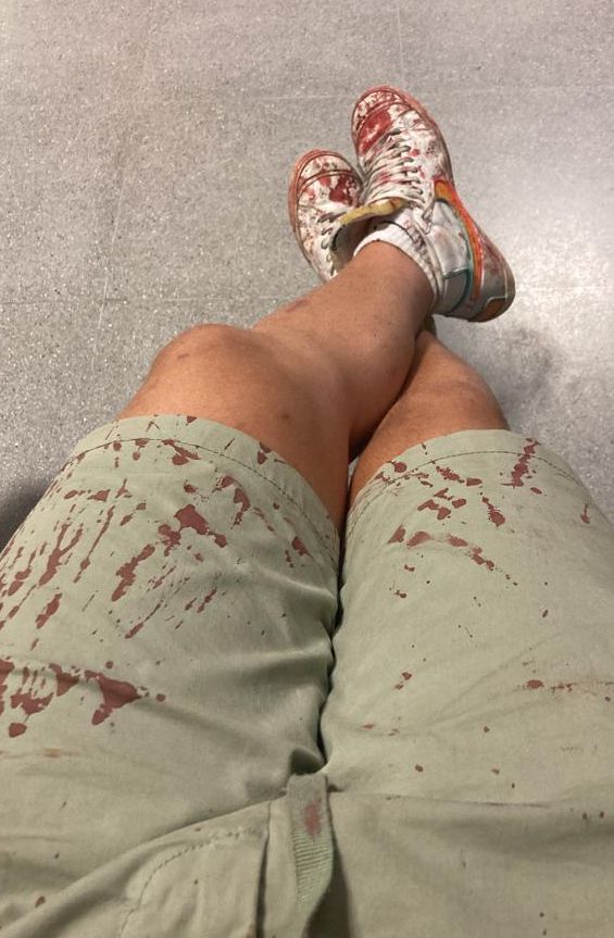 Estado que presentaba la ropa del joven tras la agresión.