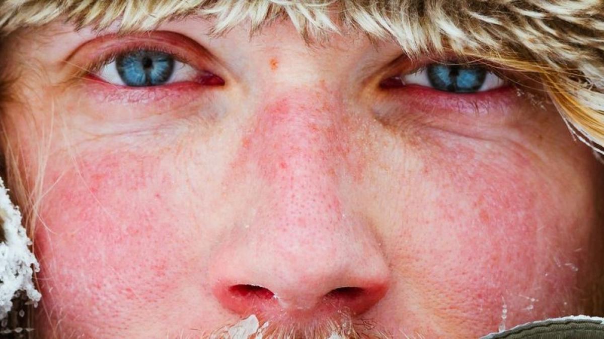 Existen diferentes trucos para cuidar tu piel en invierno.