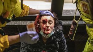 Mujer herida en el ojo por el disparo de una bala de foam de los Mossos d’Esquadra durante los disturbios en la manifestación por las protestas del encarcelamiento del rapero Pablo Hasél