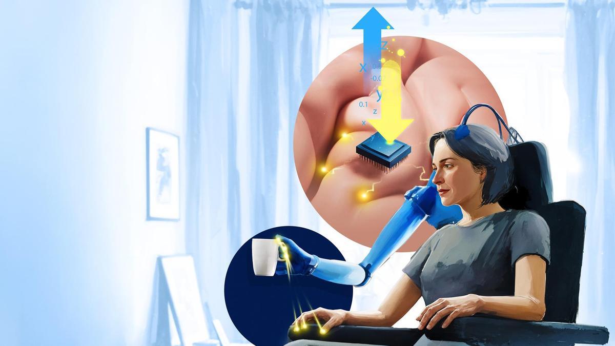 Ilustración en la que se muestra el funcionamiento de la mano biónica diseñada para ayudar a los pacientes tetrapléjicos a recuperar el tacto.