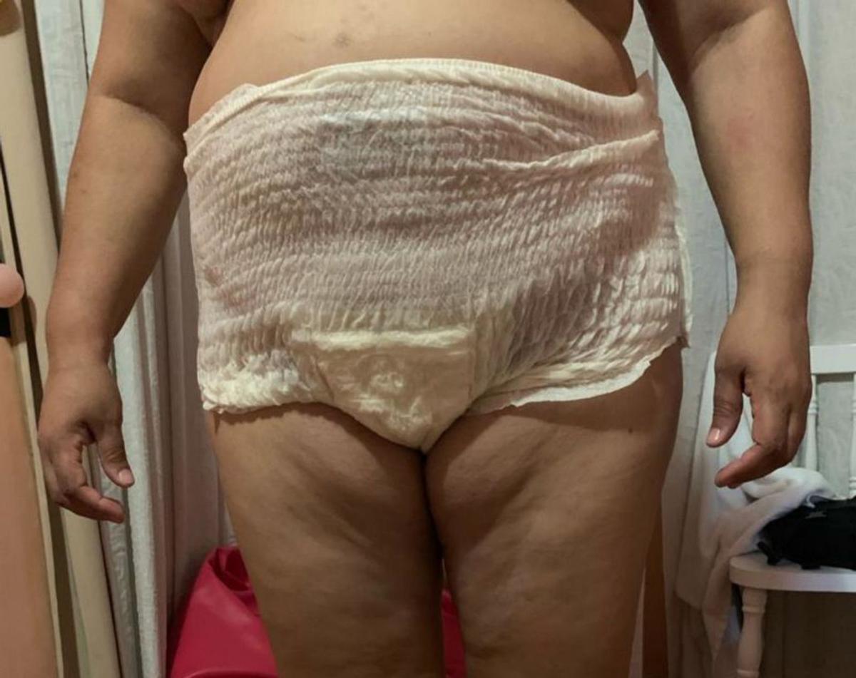 Kamila Ferreira, mostrando el pañal que usa por la incontinencia