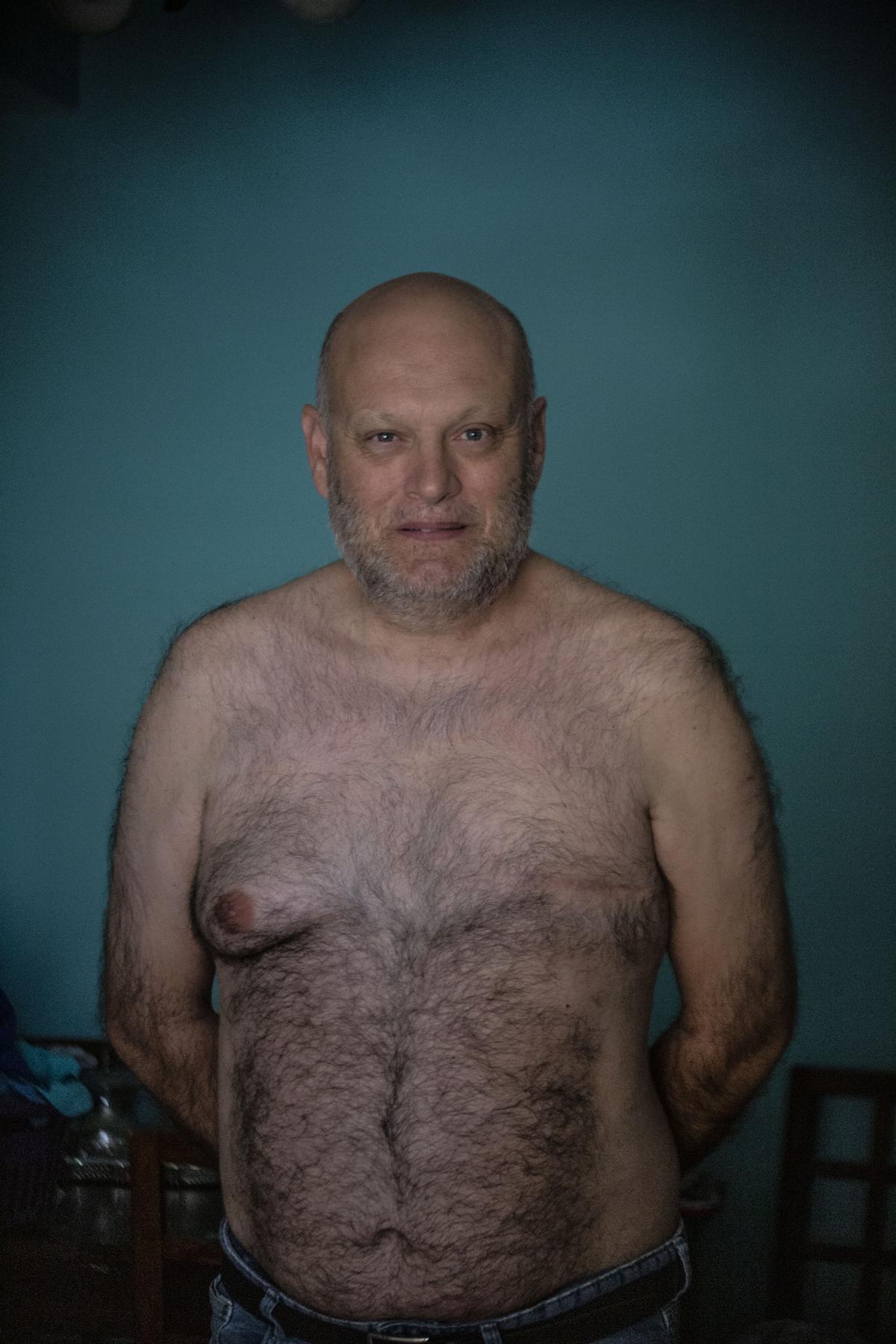 A Jorge Talavera le extirparon la mama izquierda hace 10 años