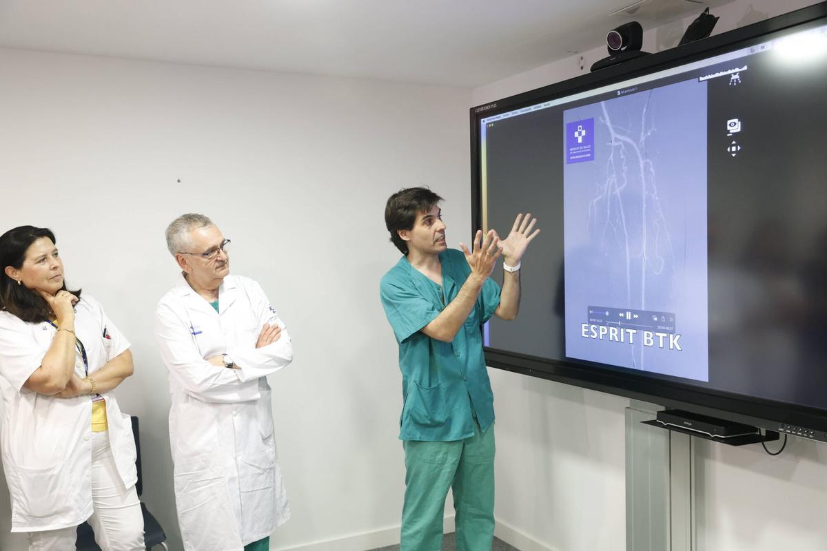 El servicio de Angiología y Cirugía Vascular ya ha realizado dos intervenciones con este procedimiento.