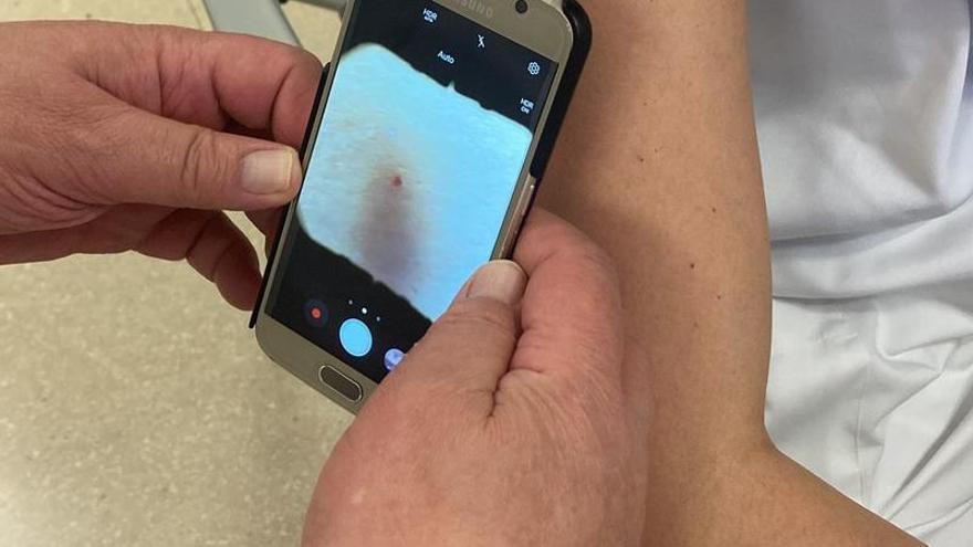 Una fotografia del mòbil amb el dermatoscop incorporat que fan servir els metges de primària per efectuar imatges de les lesions cutànies dels pacients.