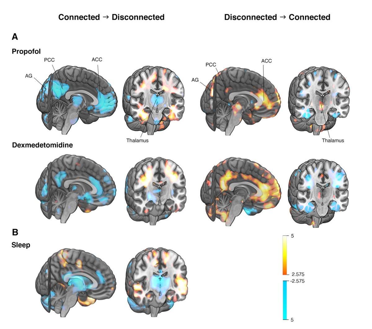 Una misma red neuronal modula la consciencia y la inconsciencia