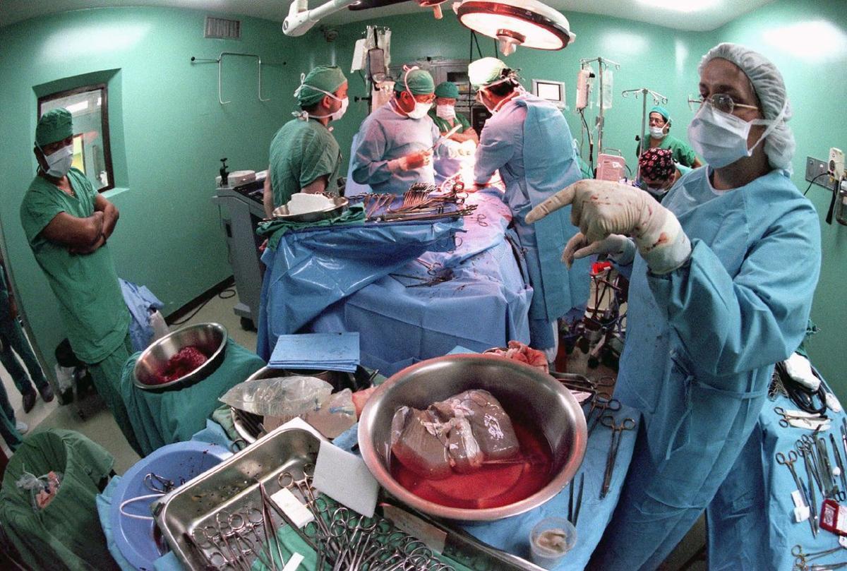 Una operación de trasplante de hígado en un hospital