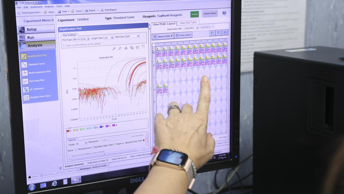 Fotografía de archivo en la que se registró una pantalla de un ordenador del laboratorio de arbovirus y enfermedades víricas del Centro Nacional de Microbiología de España, tras conseguir el primer borrador de la secuencia completa del virus causante de la viruela del mono.