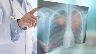 ¿Te cuesta respirar bien o sufres de tos constante? Esta fruta podría ayudarte más de lo que imaginas