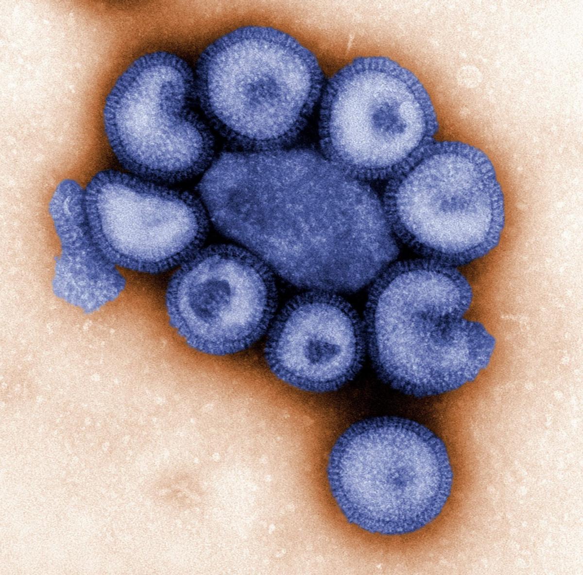 ¿La gripe de este año llegará antes y será peor?