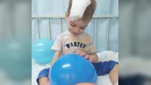Sant Joan de Déu aconsegueix extirpar més del 90% del tumor cerebral del nen Oliver
