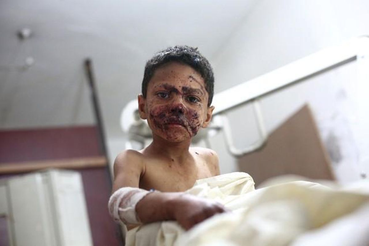 Un nen sirià espera a ser atès després de resultar ferit durant el bombardeig que l’11 de novembre el règim sirià va realitzar contra els habitants de Duma.