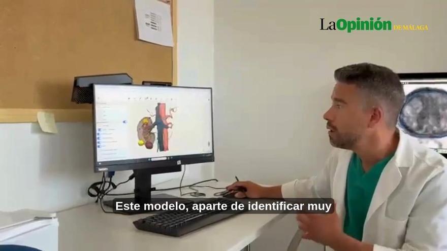 El ‘mapa’ 3D con IA que ayuda a operar el cáncer renal en el Hospital Clínico de Málaga