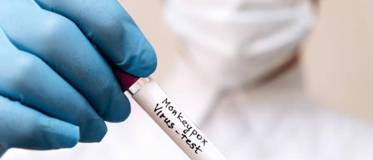 Test del virus de la viruela del mono