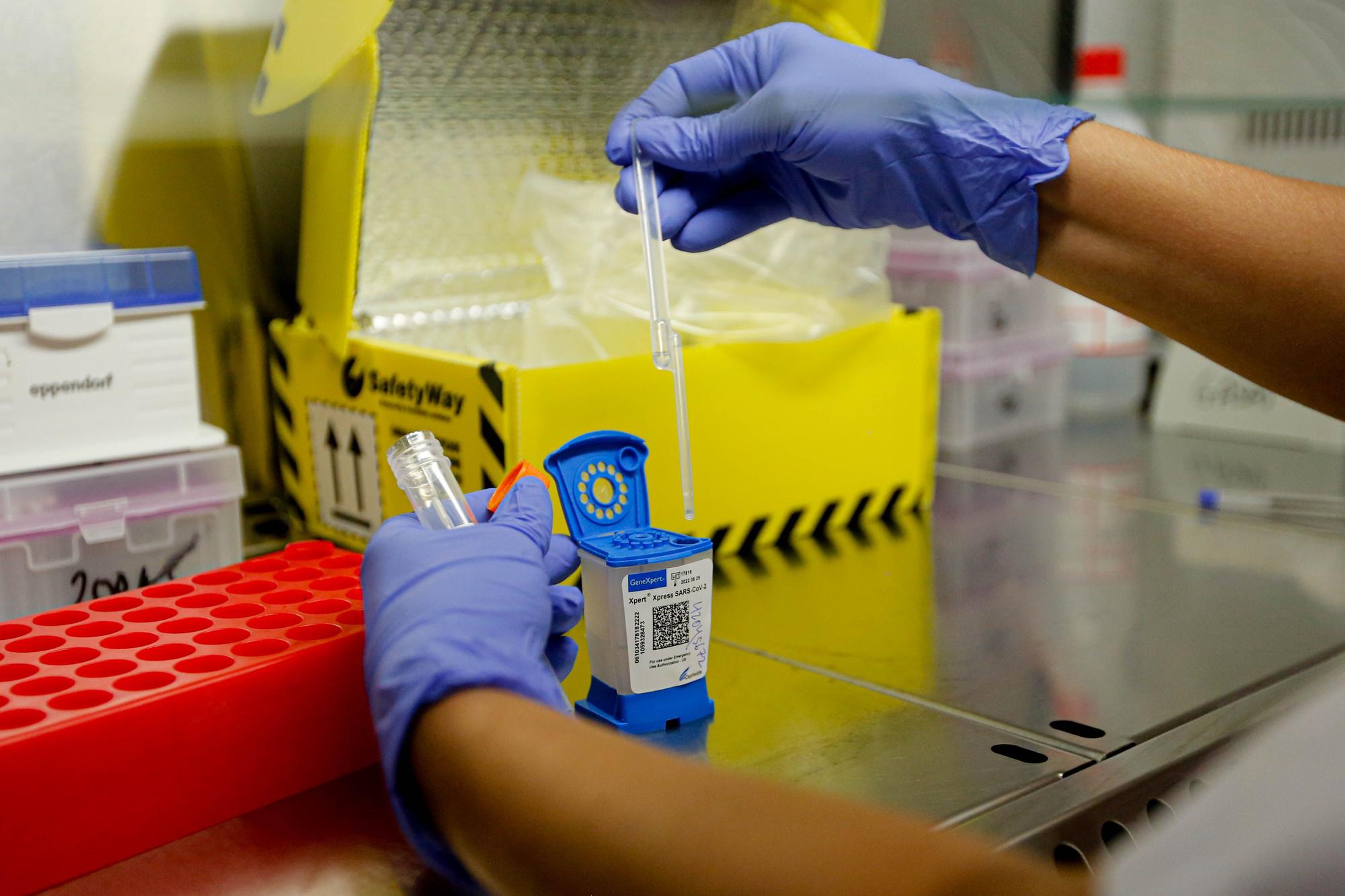 PCR: más allá del coronavirus