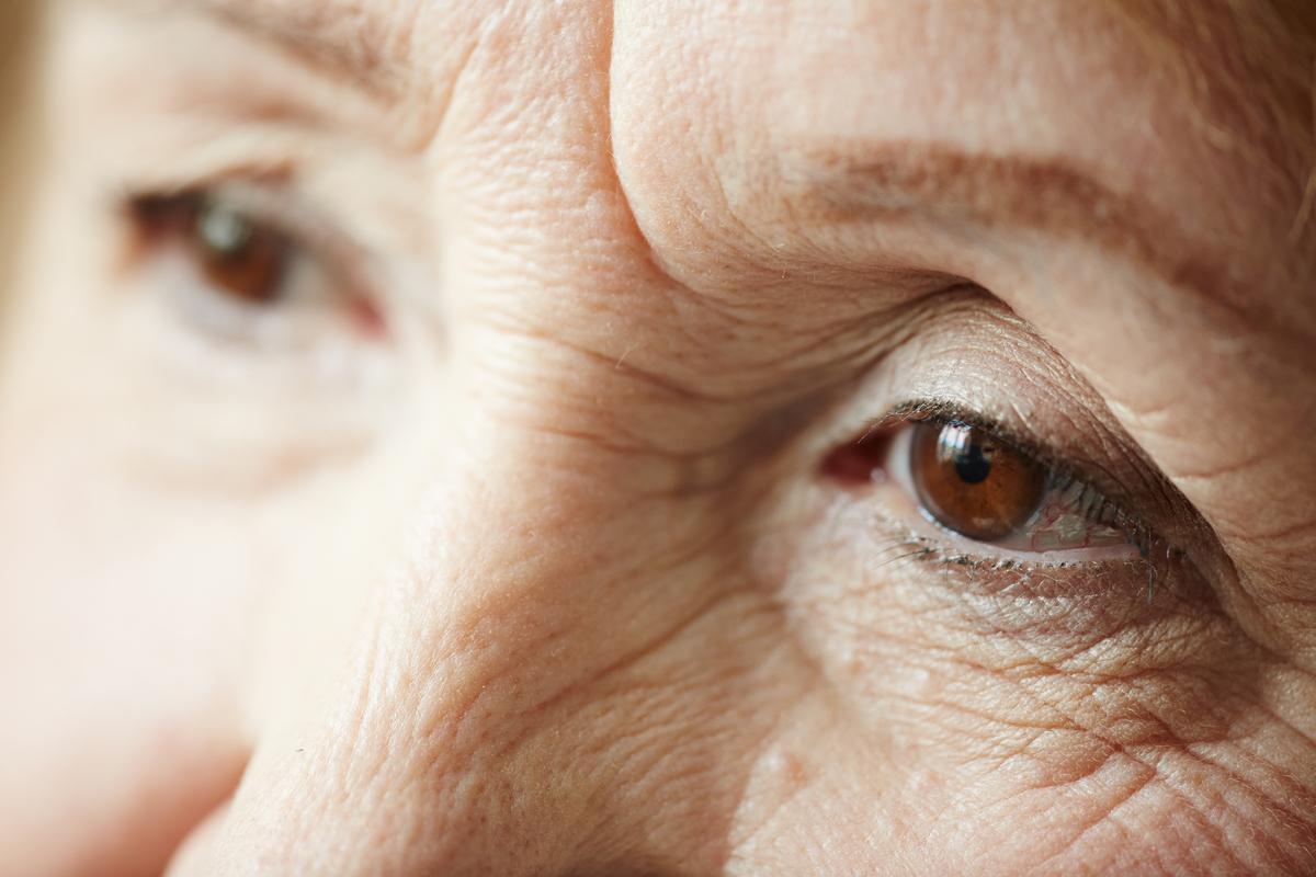 La miopía multiplica el riesgo de padecer glaucoma, la segunda causa de ceguera en el mundo