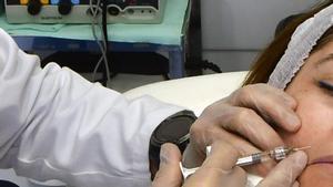 La medicina estètica abandona el bòtox i busca l’efecte natural