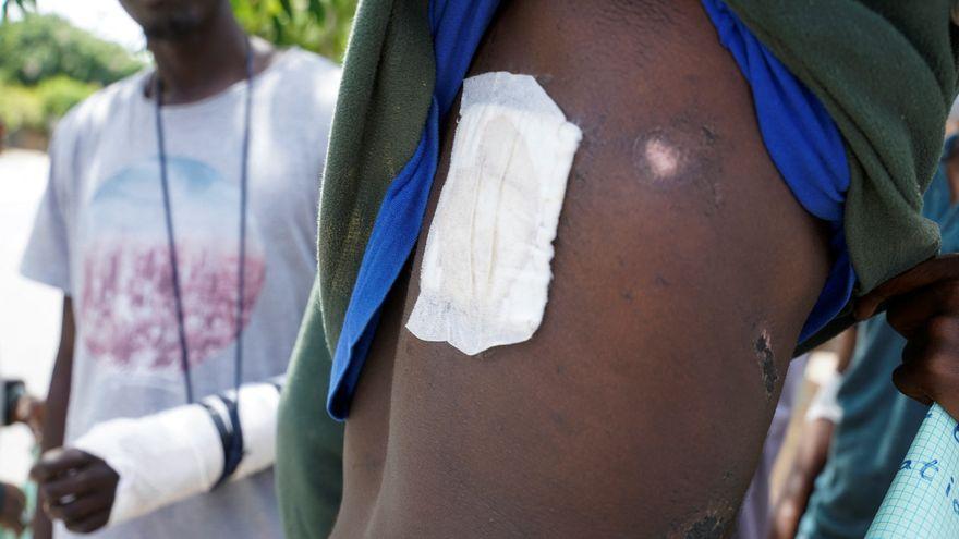 Uno de los migrantes que intentaron saltar la valla de Melilla muestra las heridas que sufrió durante una protesta frente a la sede de la ACNUR en Rabat.