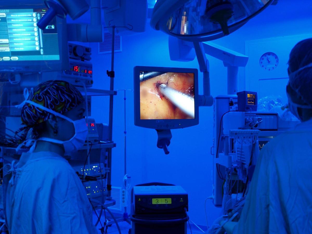 Cirugía laparoscópica. Operación en el Hospital General de Castellón.