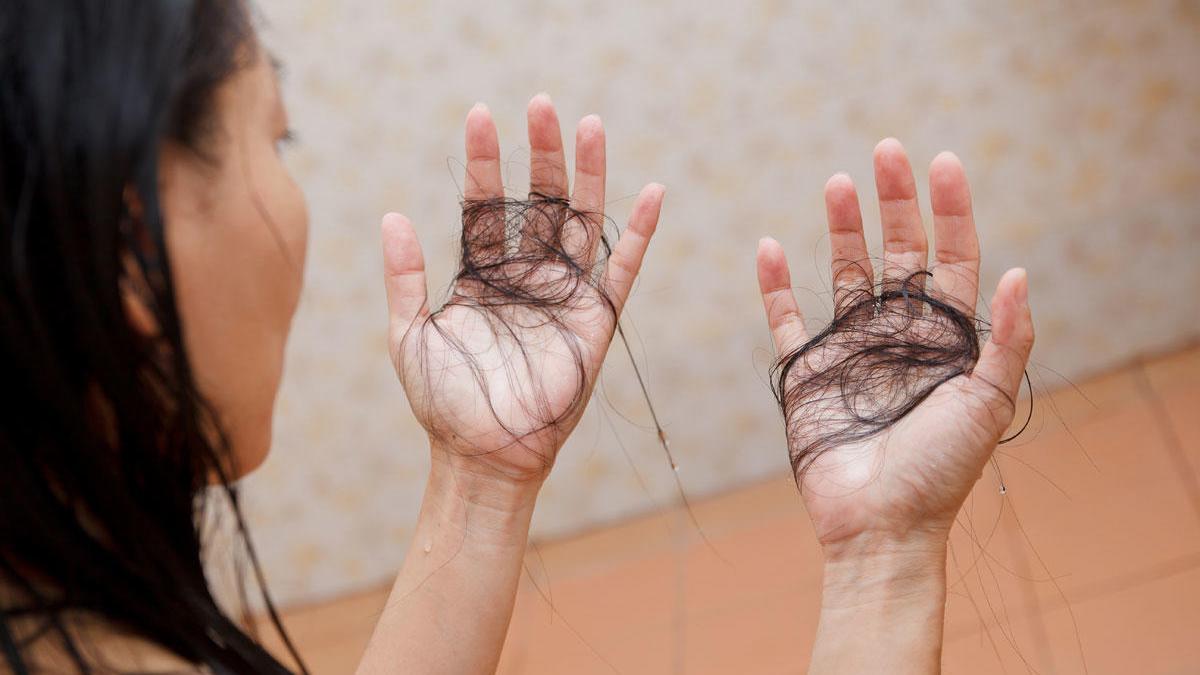 Caída del cabello, posible efecto secundario del coronavirus.