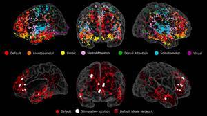 Los electrodos en múltiples regiones del cerebro dieron una mejor imagen de la actividad cerebral en tiempo real. Los puntos rojos en las imágenes inferiores muestran las ubicaciones de los electrodos en el DMN.