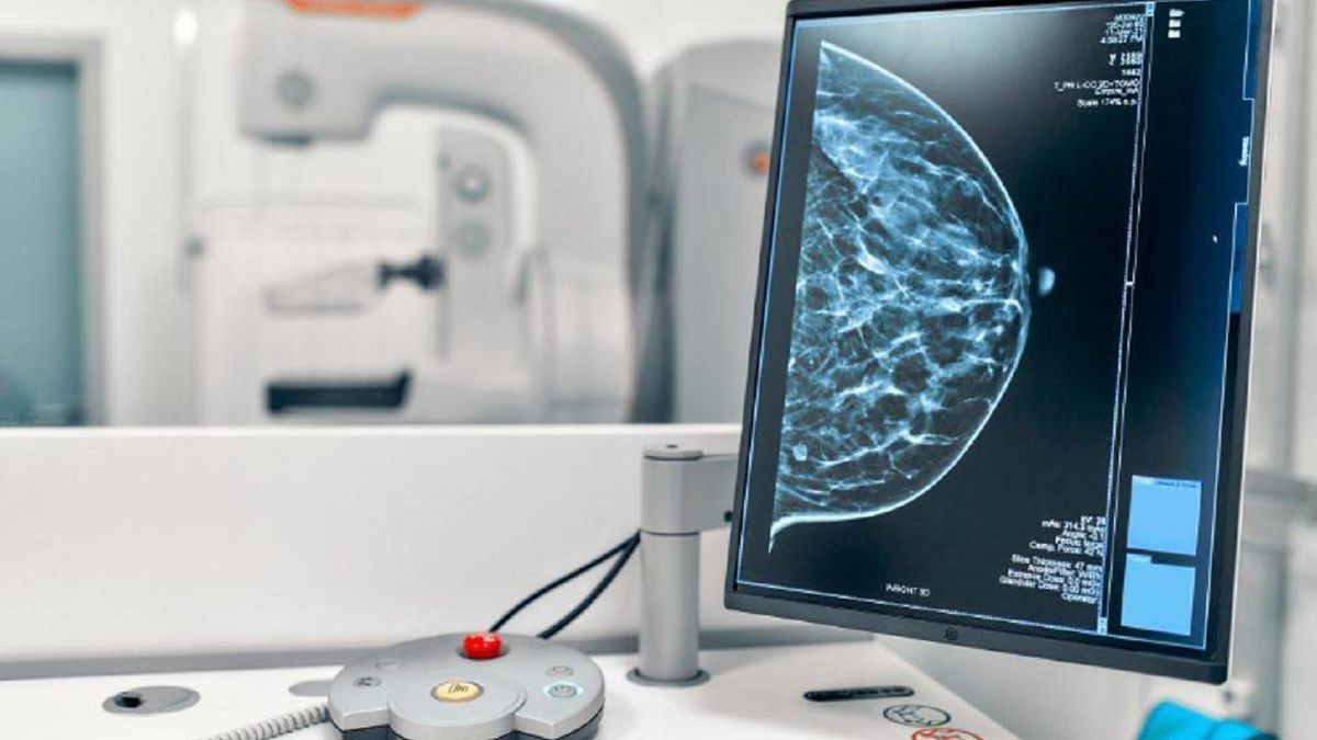 Imagen del mamógrafo de tecnología 3D.