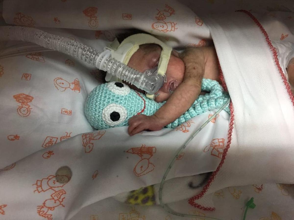 El Hospital General de Alicante logra sacar adelante a una niña prematura de 490 gramos