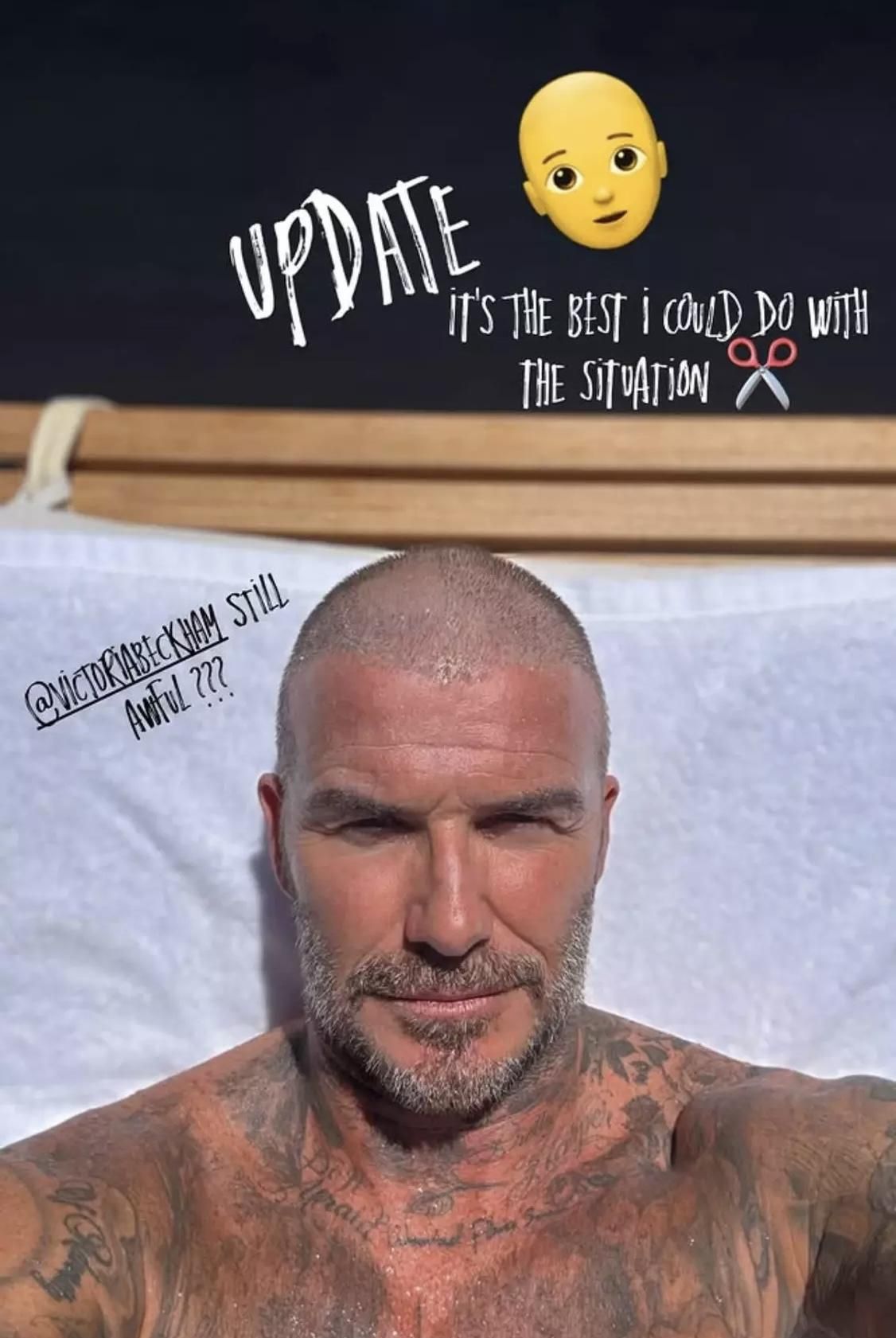 David Beckham ha encontrado la solución perfecta al drama capilar