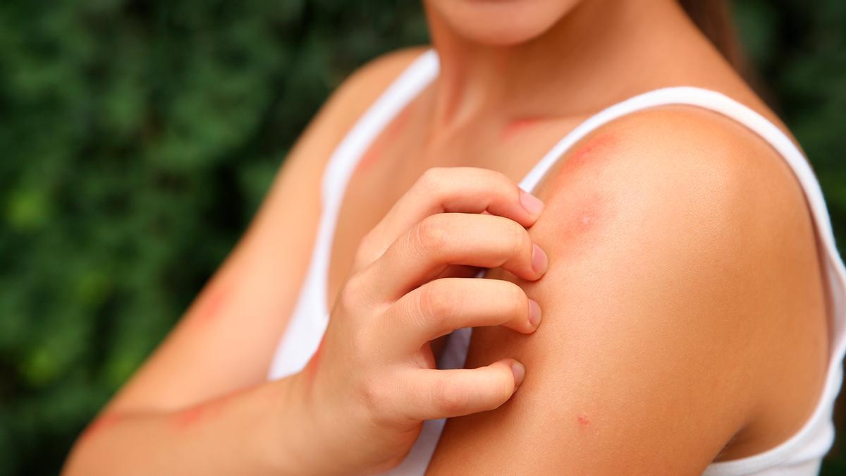 El bol que debes poner en el jardín para que no te pique ningún mosquito este verano