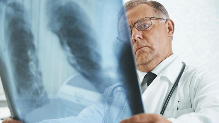 Un médico observa una radiografía de los pulmones de un paciente.