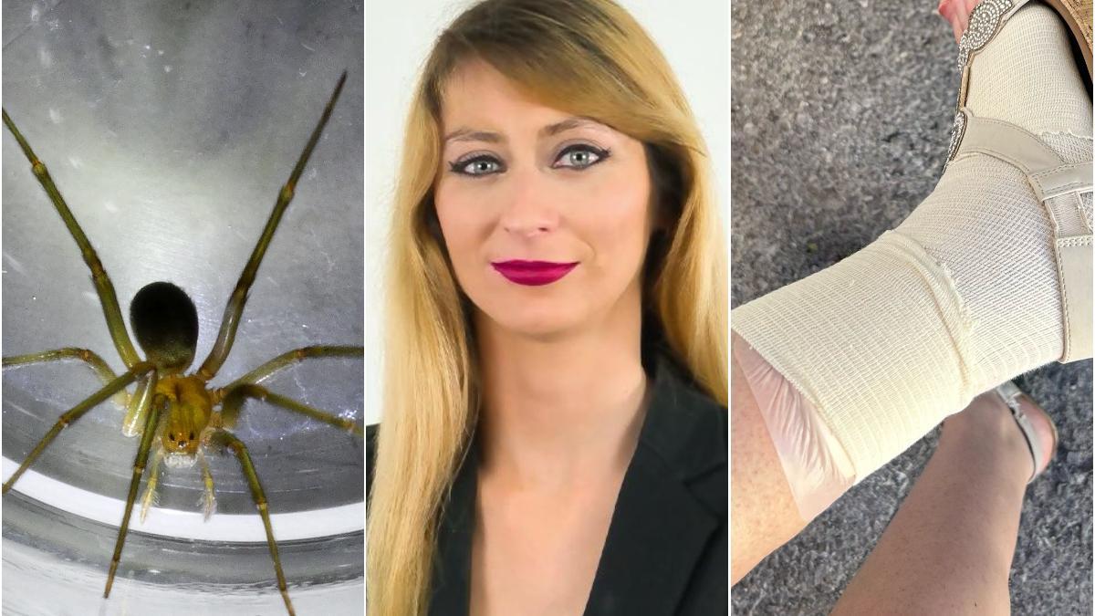 La araña, Teresa y su pierna vendada