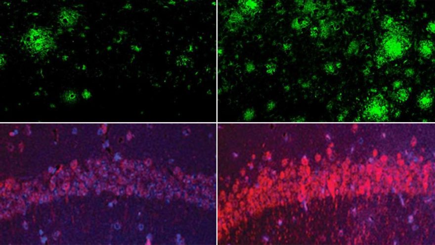 El litio, una nueva esperanza para revertir el Alzheimer