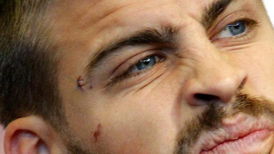 Gerard Piqué todavía luce en su rostro las heridas que le ocasionó el accidental gol de Suiza.