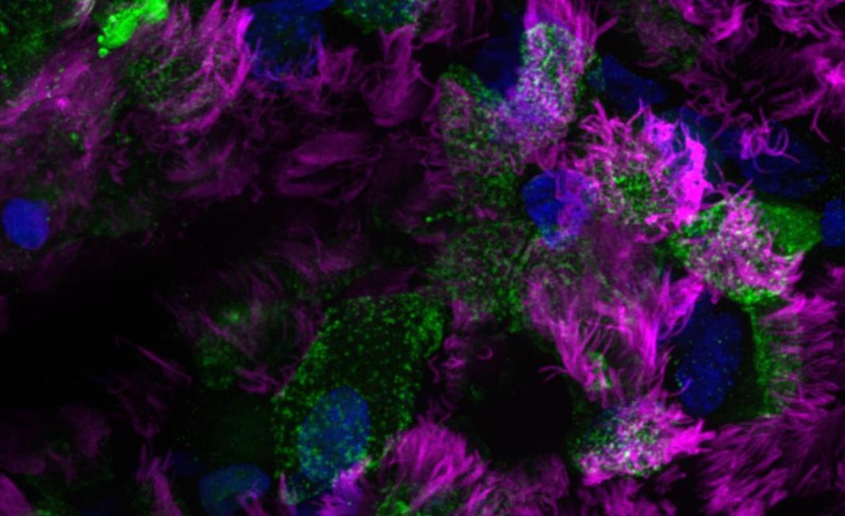 Imagen de los cilios que recubren nuestro sistema respiratorio.