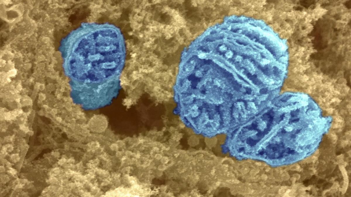 Tres mitocondrias rodeadas de citoplasma.