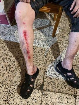 Herido tras caer en una rejilla de alcantarilla en Casablanca I.