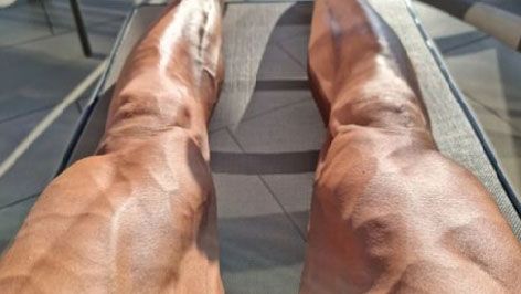 Las piernas de Zlatan once semanas después de su lesión | @iamzlatanibrahimovic