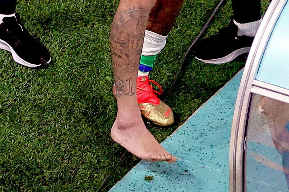 Así quedó el tobillo de Neymar