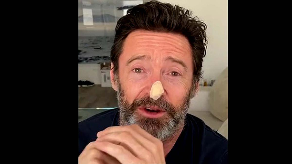 Vídeo | El càncer de pell torna a amenaçar Hugh Jackman: dues noves biòpsies