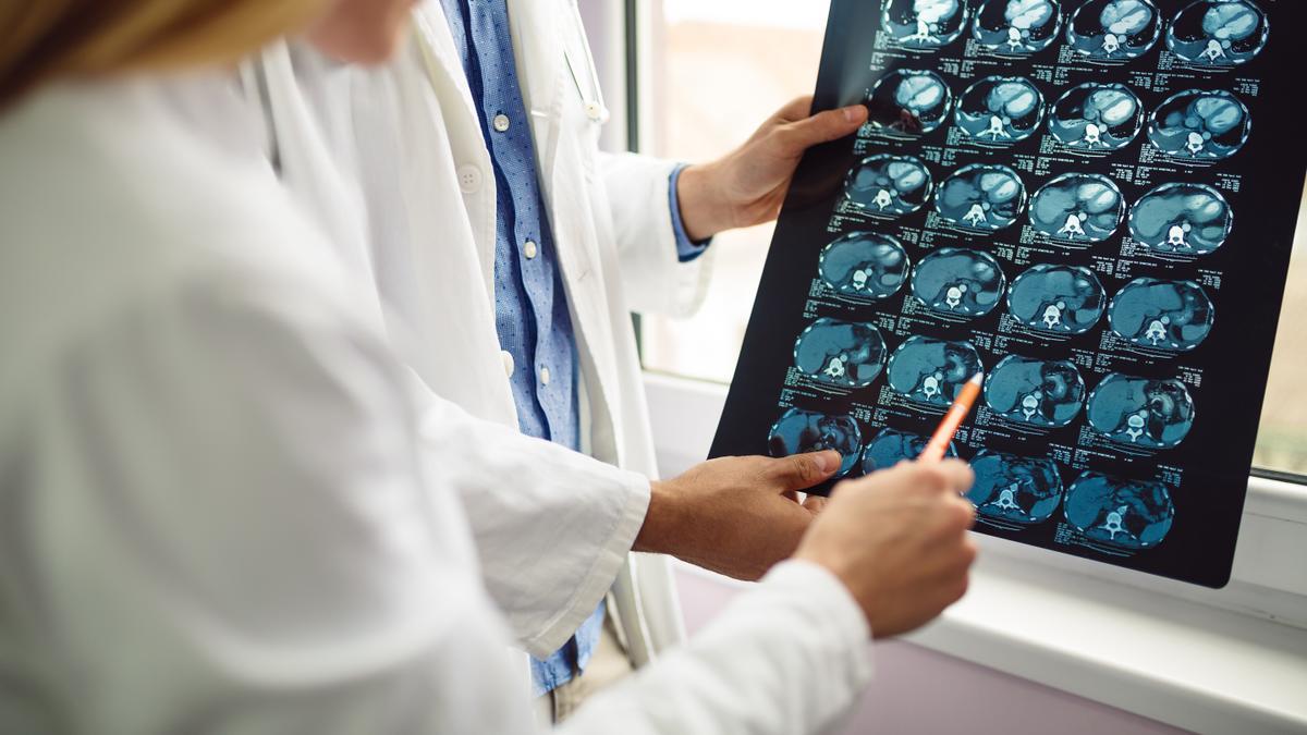 Dos profesionales mirando una prueba diagnóstica por imagen de un cerebro.