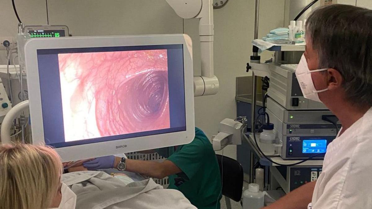 Un equipo médico realiza una colonoscopia
