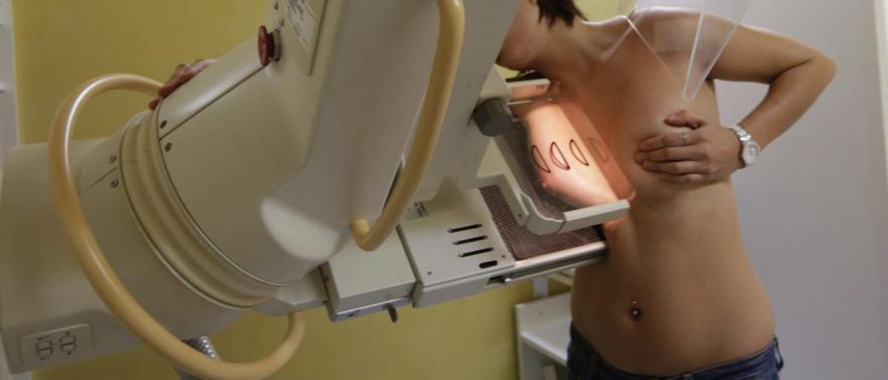 Una mujer sometiéndose a una mamografía en un hospital.