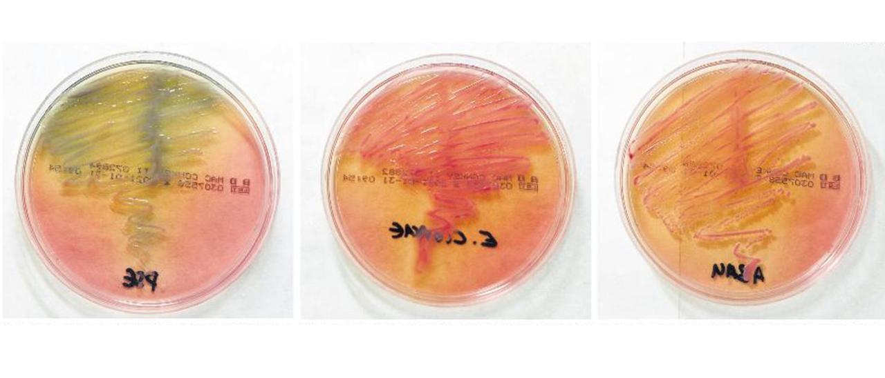 Placa con pseudomonas aeruginosa en el Hospital Can Misses. / Acinetobacter baumanii, en una placa de cultivo en Can Misses. / Cultivo de enterobacter cloacae en el laboratorio de Microbiología.