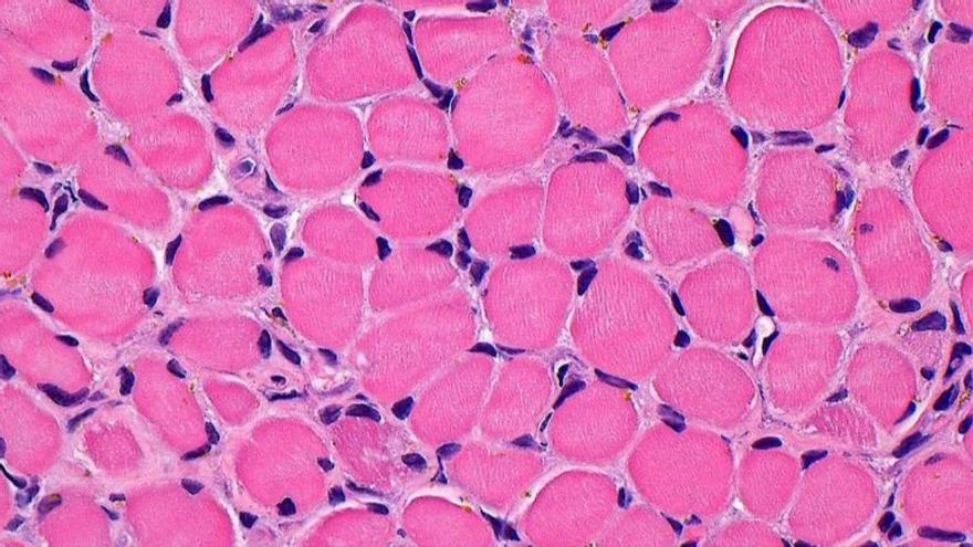 Un innesto muscolare imita gli effetti dell'esercizio: aumenta la forza, la massa muscolare e la densità ossea